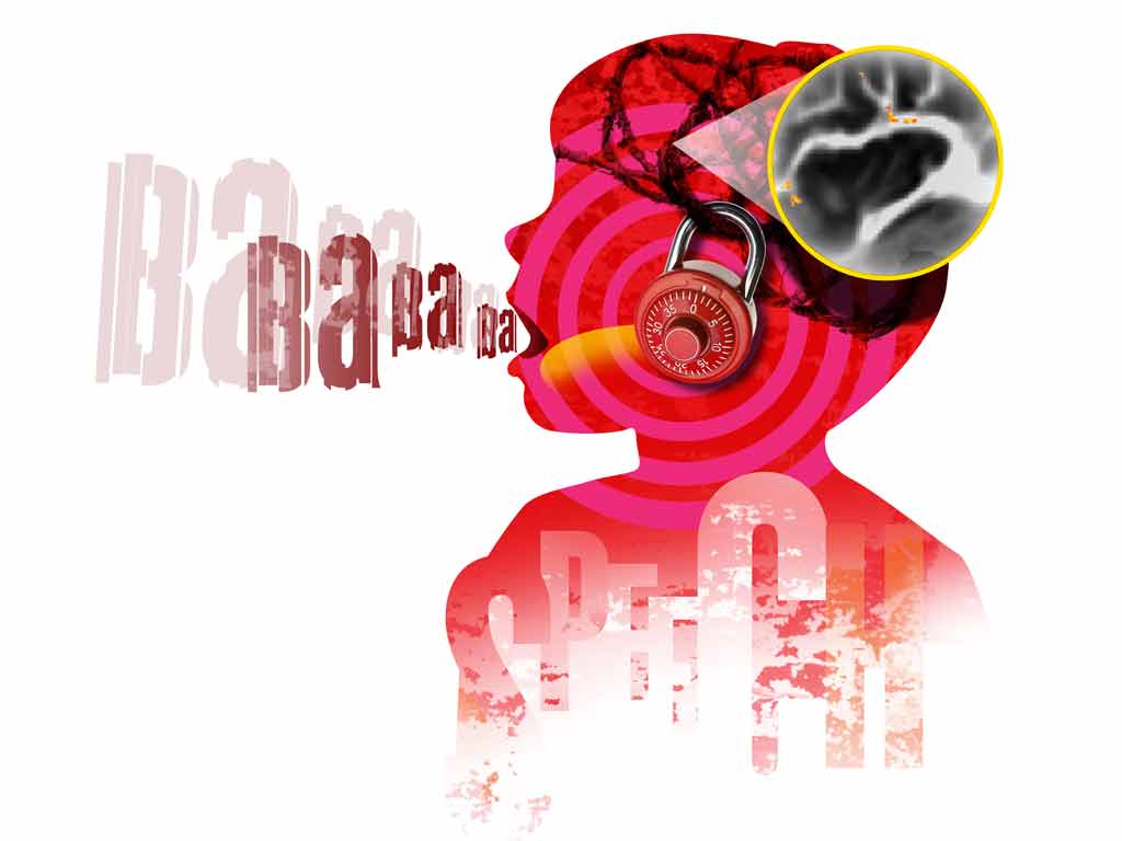 Illustration for Brain: A Journal of Neurology